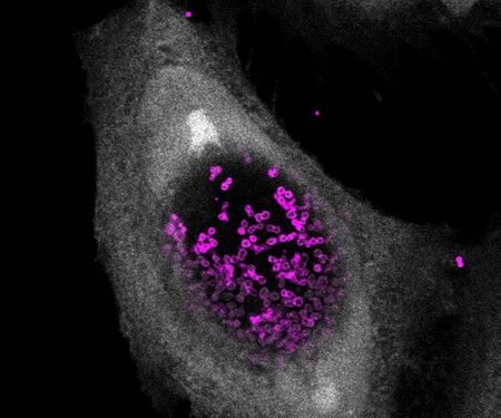 Researchers find molecule to kill sexually transmitted chlamydia