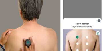 AI-powered digital stethoscopes show promise in bridging screening gaps