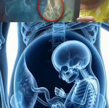 Cong leaders slam Vijayan govt over ‘isolated incidents’ claim in Kerala health sector