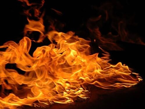 ‘Wasn’t answering my calls’: Jammu woman sets herself ablaze after boyfriend ‘ignores’ her