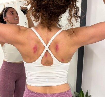 Taapsee Pannu shares glimpse of bruised back after working out on rough floor