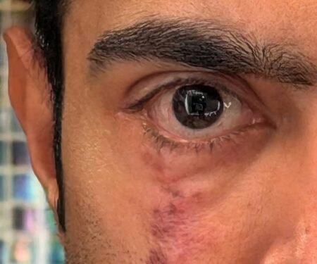 Abhishek Banerjee’s ‘scar’ post sparks political buzz amid US eye treatment